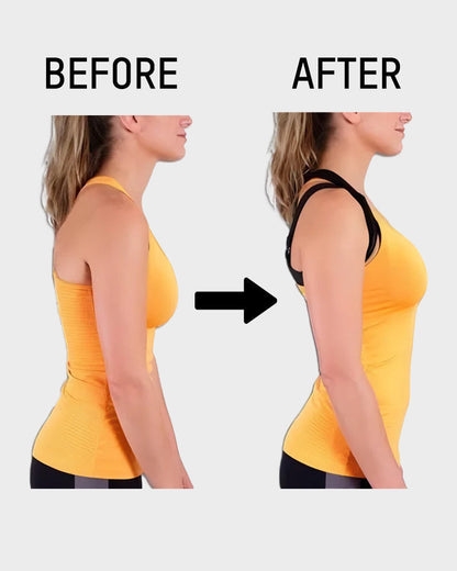 🎉 50% OFF Flash Sale⚡Front Closure Cross-Back Wireless Posture Bra