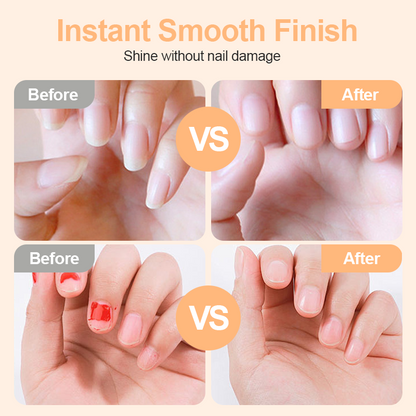 🔥2026 HOT SALE🔥💞50K+ SOLD!⚡💅 50% OFF! 2-in-1 Smart Electric Nail Clipper & Polisher